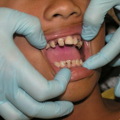 Titelbild Zahnschmerzen